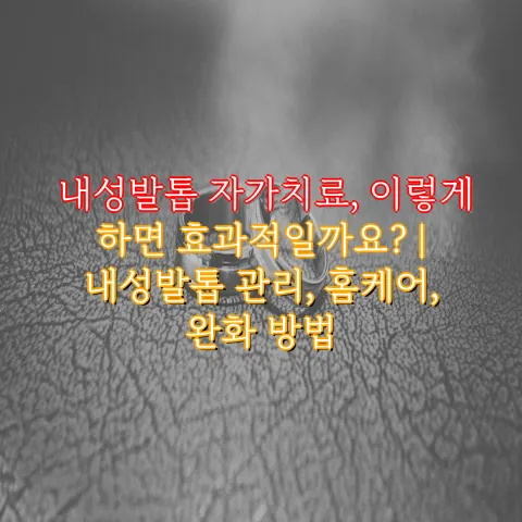 내성발톱 자가치료